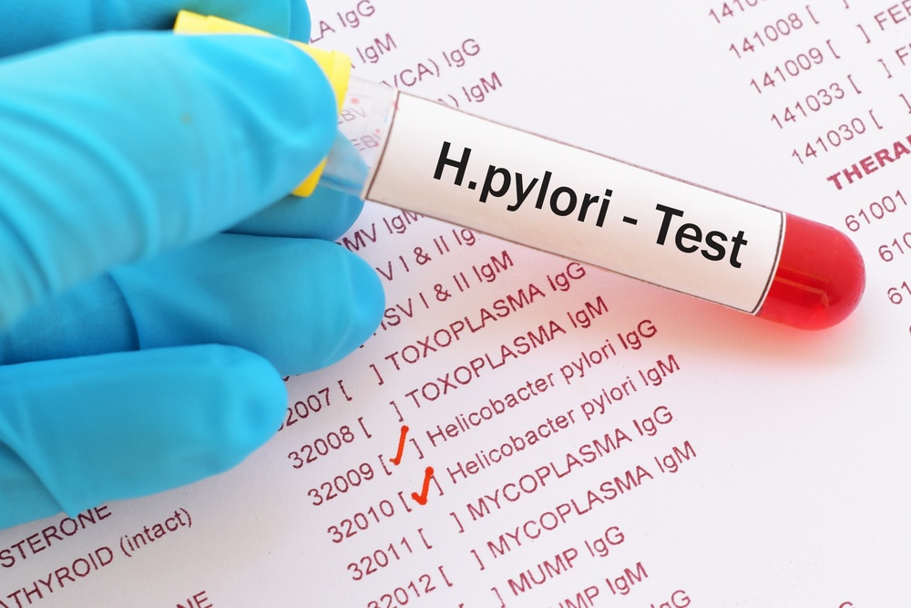 h.-pylori-test